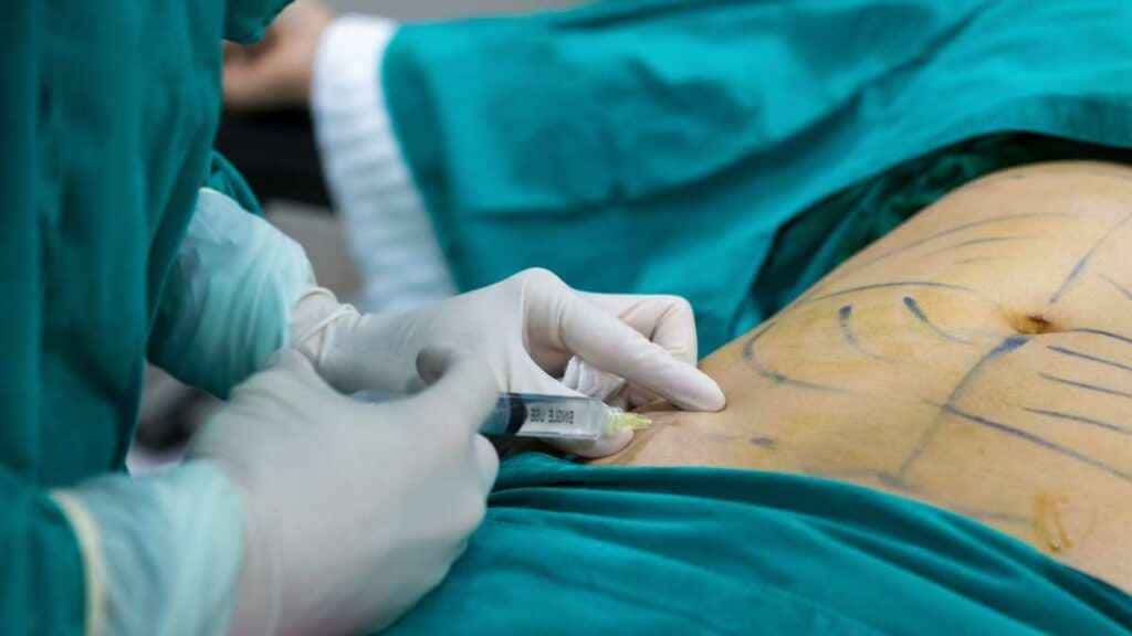 O que é Hidrolipoclasia? Saiba mais sobre este procedimento estético ...