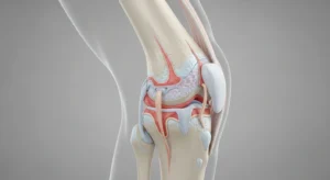 Artrose no joelho aos 40: por que pode acontecer e o que fazer Artrose no joelho aos 40